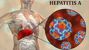Járványügyi veszélyhelyzet: Bezártak egy balmazújvárosi óvodai csoportot a hepatitis A-vírus megjelenése miatt